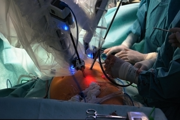 Robotická operace cév